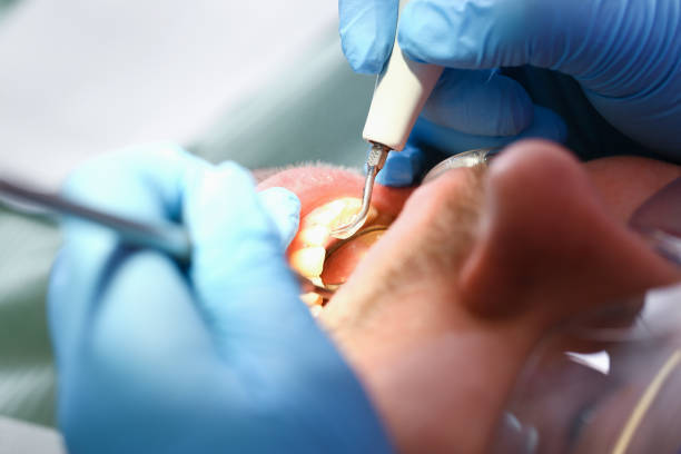 Best Pediatric Emergency Dentist in Logansport, IN